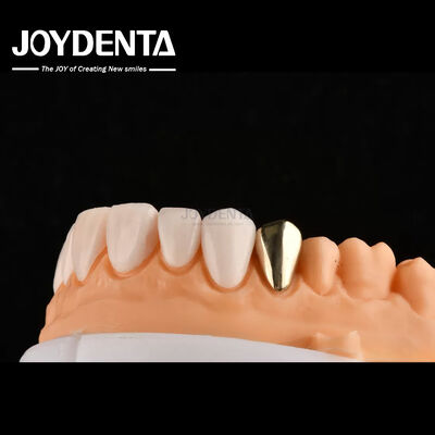 comprar Ultra Thin IPS Emax Press Veneers Veneers cosméticos para dentes para restaurações anteriores e posteriores fabricação em linha