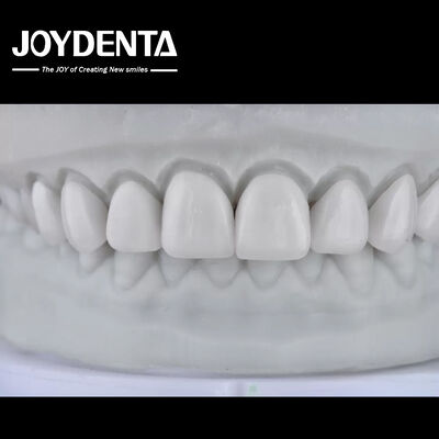 comprar Visualize the Result, Secure the Case: Our Diagnostic Wax-Up Service fabricação em linha