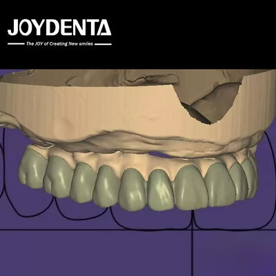 comprar Desenho individualizado Diagnóstico Digital Wax Up Laboratório Software Integração perfeita fabricação em linha