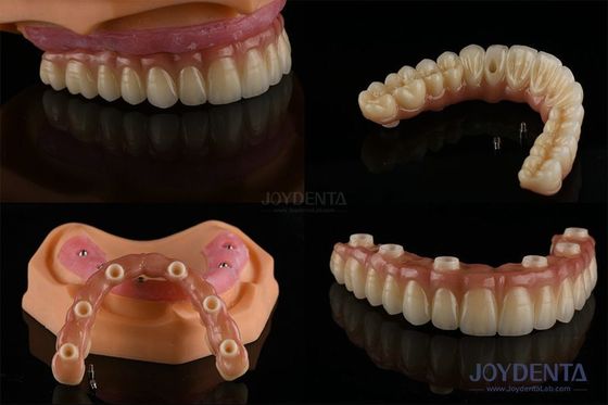 Dentistas Dentes múltiplos Implantes de superfície rugosa Componentes protésicos