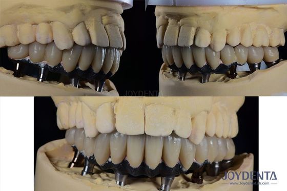 Implante Dental de Dentes Múltiples de Titânio Cirurgia Protética Conexão Externa Hexagonal