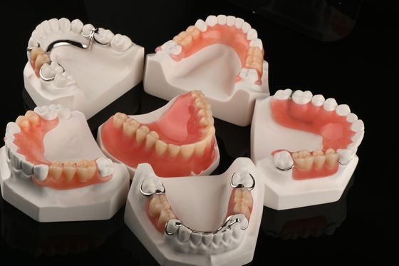 Dentes artificiais Dentes parciais removíveis