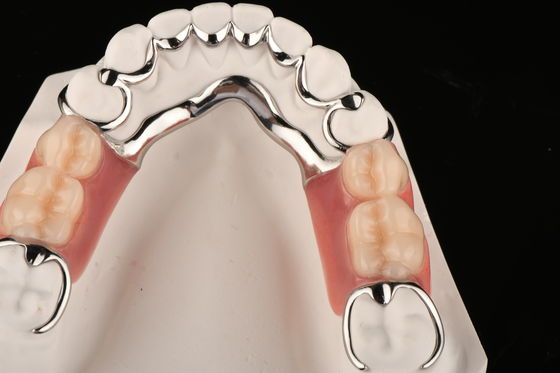Dentadura parcial acrílica resistente a manchas para conforto natural, substituindo dentes perdidos