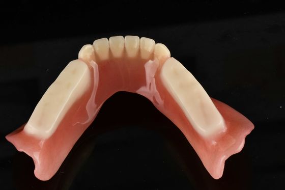 Dentes artificiais de acrílico hipoalergênicos adequados para substituição de dentes de aparência natural
