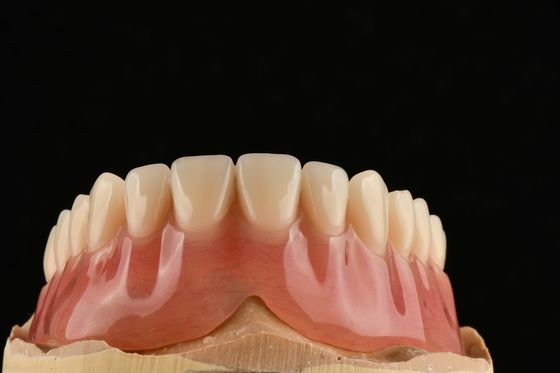 Dentes parciais removíveis ajustáveis e confortáveis que se assemelham a dentes naturais