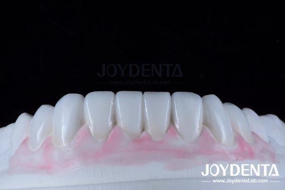 Depilação de cera digital personalizada para replicação de anatomia dentária natural