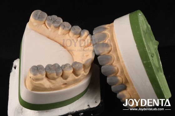 Cera dentária temporária de diagnóstico de alta precisão personalizada Espessura de 1-2 mm
