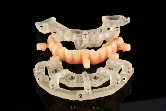 Soluções de Cirurgia Estática Guiada de Titânio para Terapia de Implantes Altamente Precisas