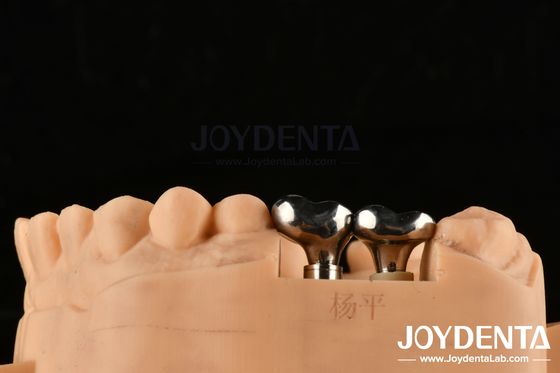 Implante Dental Prateado Abutments Diâmetro Personalizavel Altura Tecnologia CAD CAM