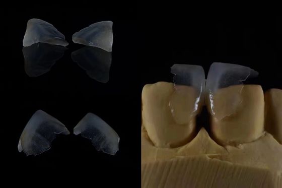 Comodidade dos folheados Dentários Forte ligação com esmalte dental para ajuste seguro Leve e suave para o conforto ideal do paciente