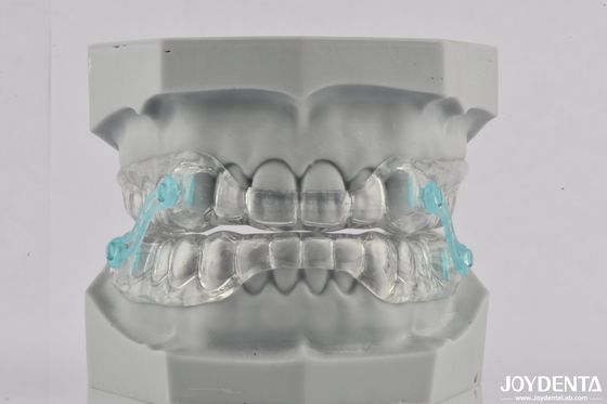 Aparelho dental de silicone anti-ronco