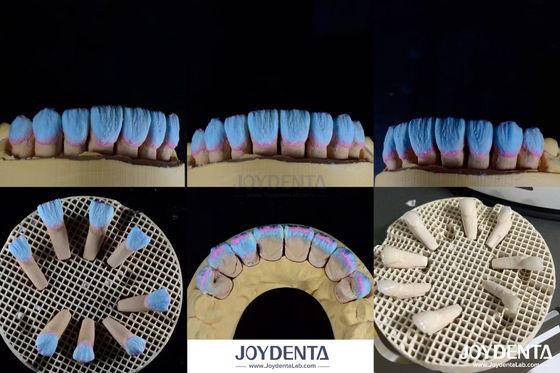 Alta biocompatibilidade Finete de cerâmica feldspática brilhante para restaurações dentárias