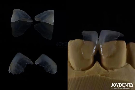 Minimalmente invasivo Cosméticos Veneers Dentários Vidro Cerâmica Cor ultra fina