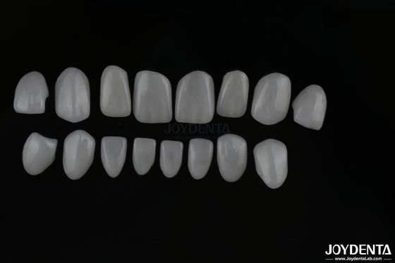 Veneers cerâmicos de vidro de aparência real com acabamento de superfície brilhante ou fosco