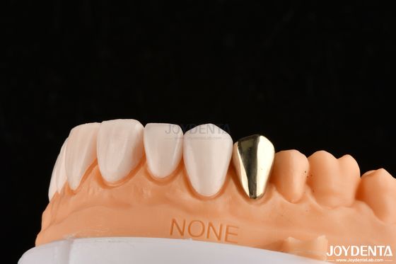 Ultra Thin IPS Emax Press Veneers Veneers cosméticos para dentes para restaurações anteriores e posteriores