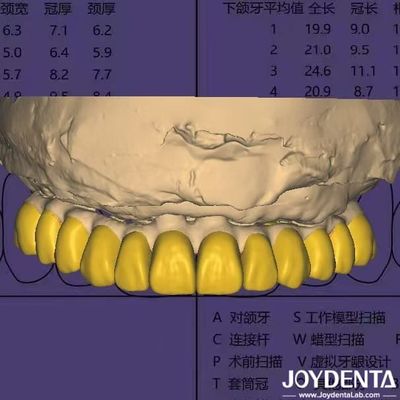 Software de design dentário Digital Wax Up com segurança de dados compatível com HIPAA