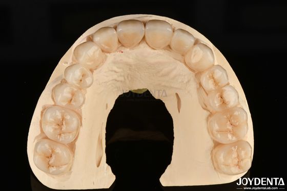 Alta resistência à corrosão Zircônio completo O material preferido para restaurações dentárias brancas