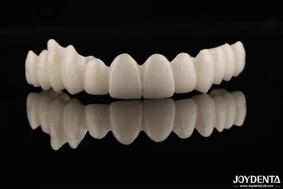 Alta estética Zirconia completa Alta resistência à corrosão e desgaste para aplicações exigentes