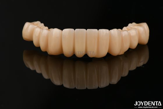 Alta precisão de contorno completo Zirconia Alta resistência a manchas para aplicações dentárias