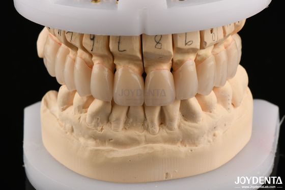 Superfície polida Resistência flexural Zircônio em camadas para pontes 6.0-6.1 G/cm3 Densidade