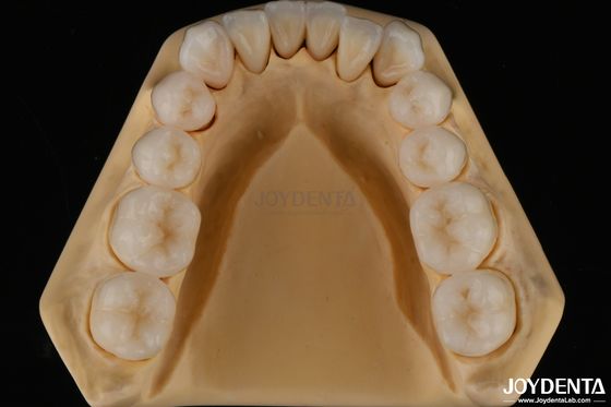3D Dental Multilayer Completo Zirconia Resistência a Fragmentação Estrutura Dental Natural