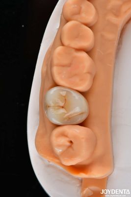 Dentário de camada múltipla coroas e pontes de zircônio de alta transparência aspecto natural