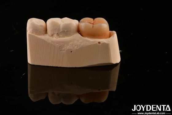 Material de restauração dentária multicamadas Zirconia completa 1200 HV Dureza Resistência a rachaduras