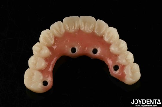 Secagem rápida Barras de titânio Dentes acrílicos acabamento Dentes acrílicos claros Produtos dentários