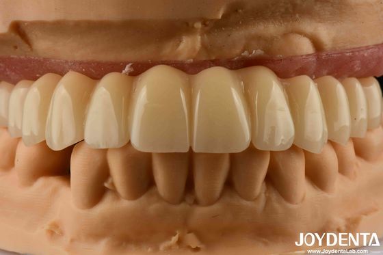 Solução dentária Ti-Base Zirconia Hybrid Bridge Alta biocompatibilidade Aparência natural