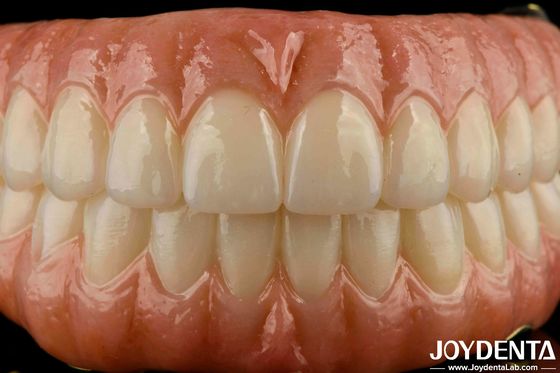 Precise Fit Dental Ti-Bar Zirconia Hybrid Bridge Substituição para Dentes Faltantes