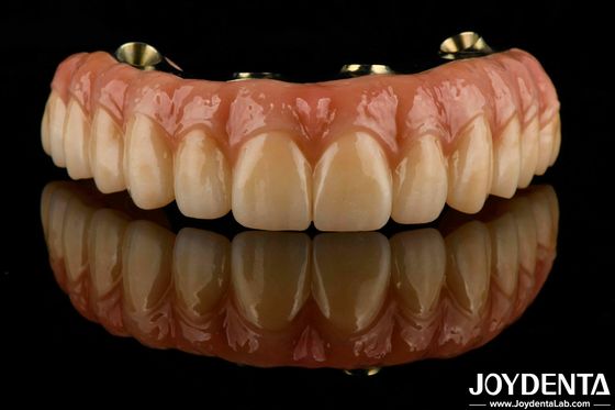 Ponte de zircônio híbrido de Ti-Bar Dental Excelente resistência Restaura a função de mastigação