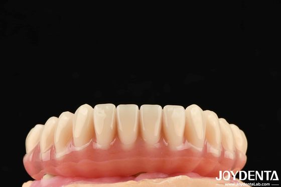 1 peça Ti-base Dentes Acrílicos acabamento de cor translúcida Resinas Dentárias Acrílicas