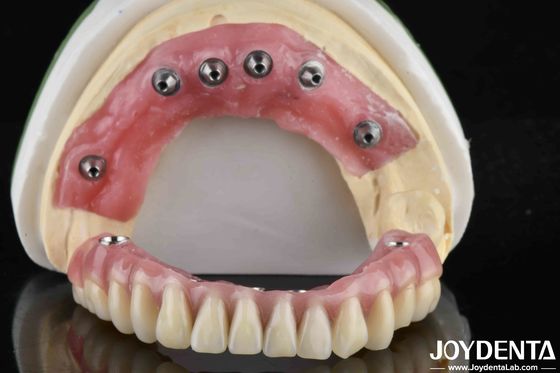Finissagem translúcida de dentes acrílicos de base de Ti para produção de laboratório odontológico