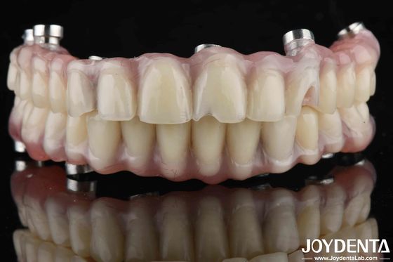 Dentes de laboratório de aparência natural de acrílico para alta resistência ao desgaste
