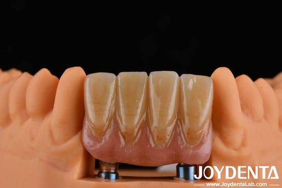 4.5 mm de altura Abutments acabados Tipo de conexão hexadecimal interna Compatível com sistemas de implantes