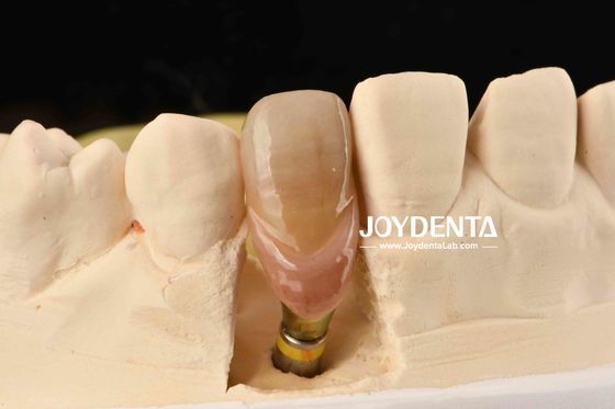 0° Angulação Abutamentos dentais acabados 1,5 mm Cabeça de fio Superfície polida
