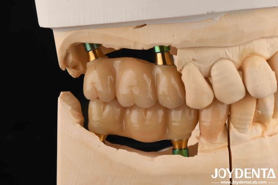 4.5mm de altura Polido hexodental interno implante dentário abutments V forma parafuso retido