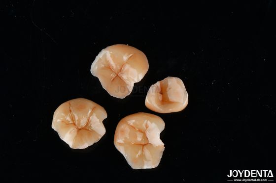 Forma personalizável Inlays e Onlays compostos Resistência à mancha dental duradoura
