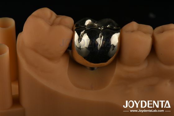 Rehabilitação Oral Cera de fundição FMC coroa de metal completo para reparação clínica dentária