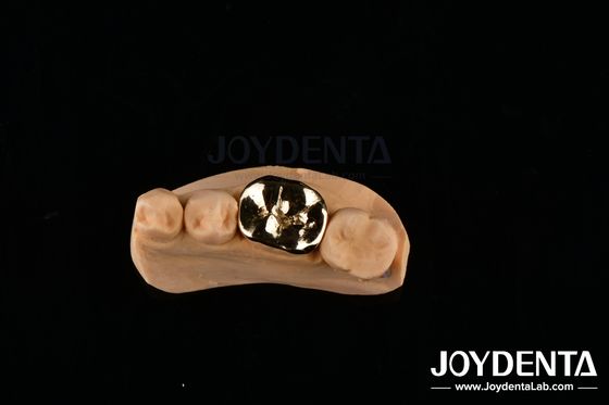 FMC Metálico Reparação Clínica Oral Materiais para Implantes Dentários Resistentes a Abrasivos
