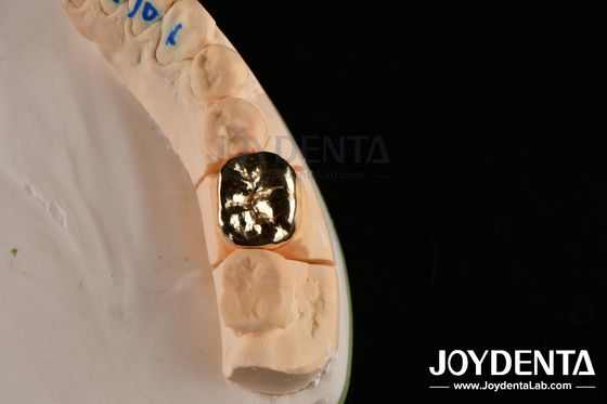 Resistência à abrasiva Cera Dental Forja FMC Coroa Para Reparação Clínica Oral