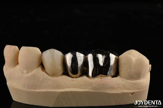 Coroa de liga de metal resistente à abrasão para restaurações dentárias personalizadas