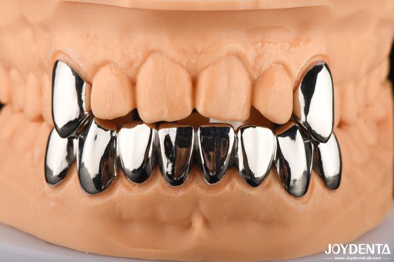 Coroa Dental Resistente a Abrasivos Full Metal, FMC Metálico Para Reabilitação Oral