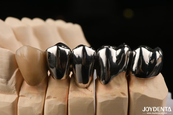Reparação Clínica Oral FMC Coroa Full Metal feita com método de produção de fundição de cera