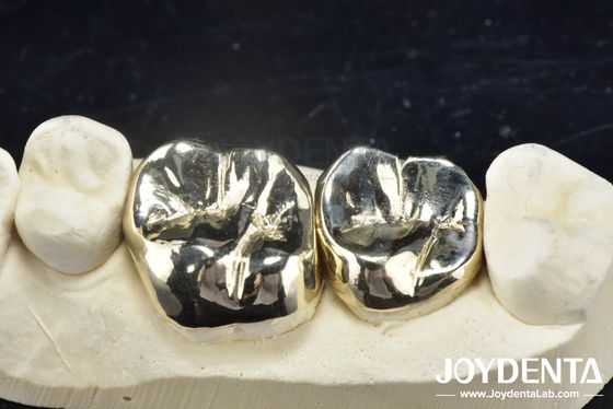 Cera de fundição reparação dental coroa de metal completo para a reabilitação oral resistente à abrasão