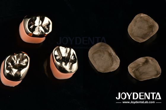 Restauração Dental Coroas de metal de ouro para tratamento de reabilitação oral