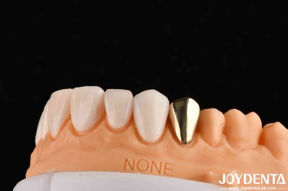 Cera de ouro fundido 60K coroas dentárias metálicas coroas dentárias de ouro resistentes a abrasivo