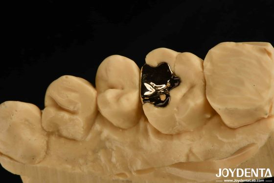 Coroa Dental Clinical Metálica de Ouro 60K Gold Dental Cap para Reabilitação Oral