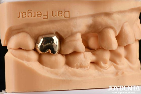 Materiais dentários de fundição de cera resistente à abrasão para melhoria da reabilitação oral