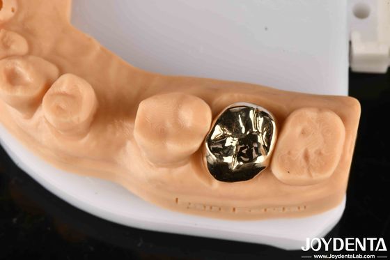 Material metálico coroa dental de ouro, coroa dental de ouro para a melhor reabilitação oral.